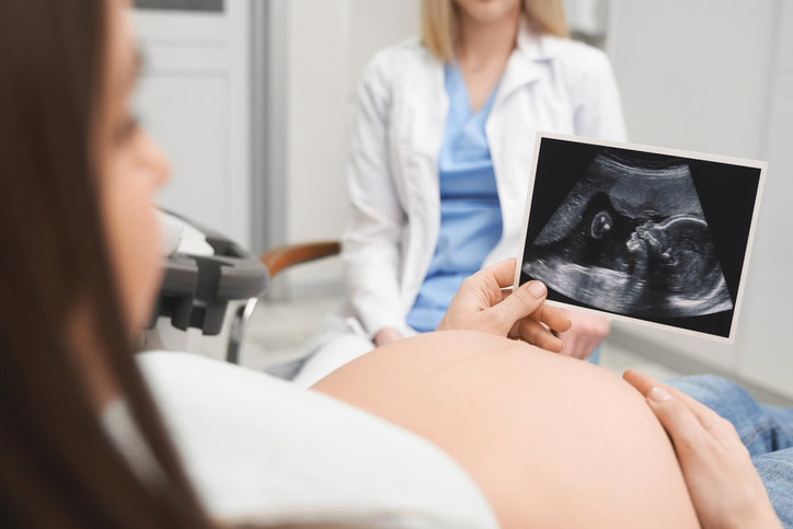 Prvi ekspertni ultrazvuk