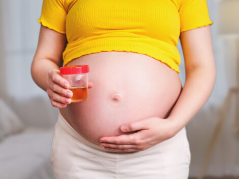 proteini u urinu u trudnoći