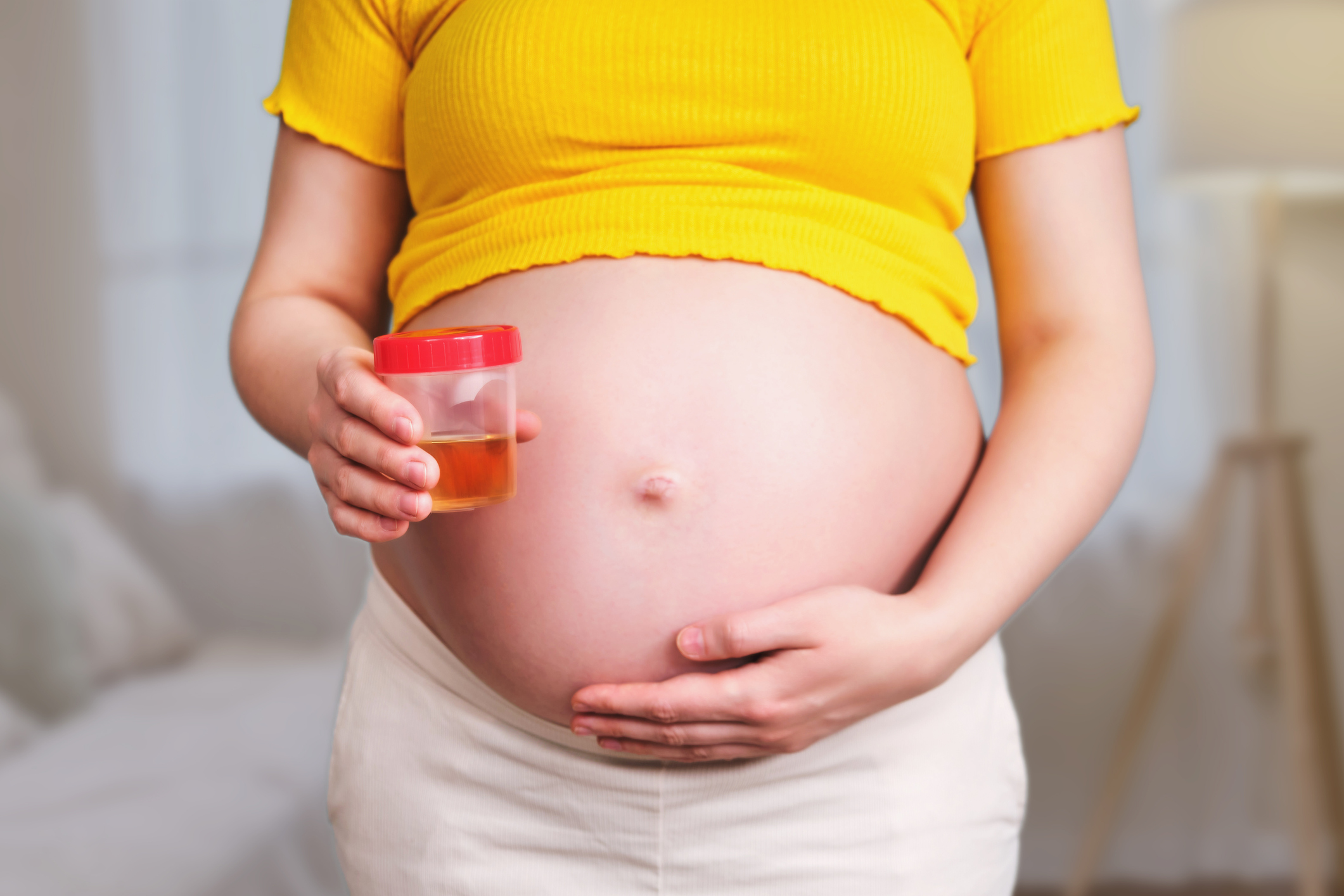 proteini u urinu u trudnoći